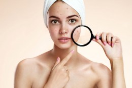 S.O.S Acnee: cum identifici ce tip de acnee ai